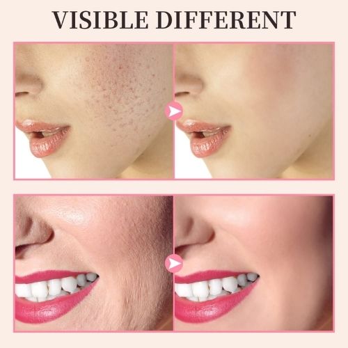 Elektrotherapie-Stab für das Gesicht