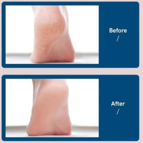 Elektrische Fußfeile